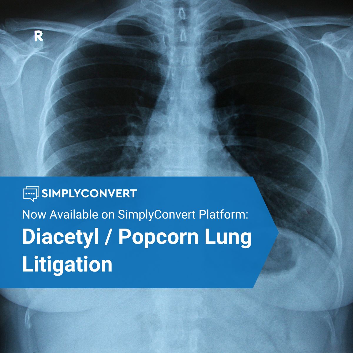 Diacetyl & Popcorn Lung
